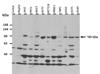 SEZ6 Rabbit Polyclonal Antibody