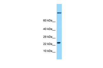 HSPB9 Rabbit Polyclonal Antibody