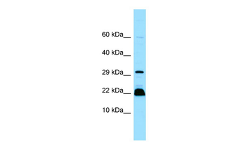 MYLPF Rabbit Polyclonal Antibody
