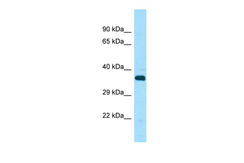 STK33 Rabbit Polyclonal Antibody