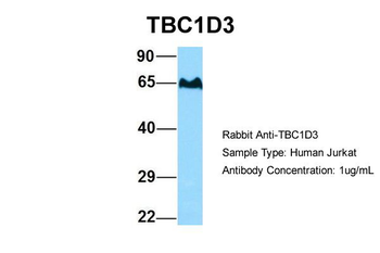 TBC1D3 Rabbit Polyclonal Antibody