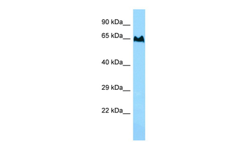TBC1D3 Rabbit Polyclonal Antibody