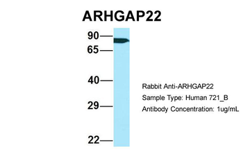 ARHGAP22 Rabbit Polyclonal Antibody