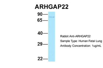 ARHGAP22 Rabbit Polyclonal Antibody