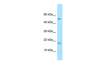 DAZAP2 Rabbit Polyclonal Antibody