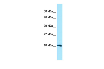 GGNBP1 Rabbit Polyclonal Antibody