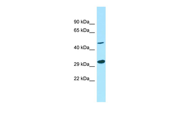 GNA13 Rabbit Polyclonal Antibody
