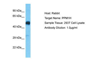 PPM1H Rabbit Polyclonal Antibody
