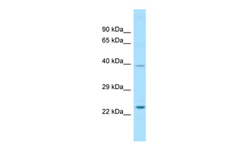 RAB29 Rabbit Polyclonal Antibody