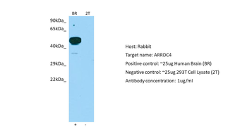 ARRDC4 Rabbit Polyclonal Antibody