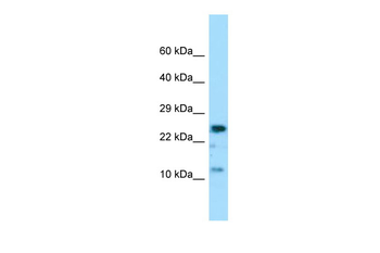 COX7A2 Rabbit Polyclonal Antibody