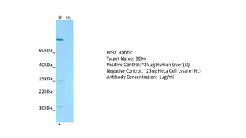 BEX4 Rabbit Polyclonal Antibody