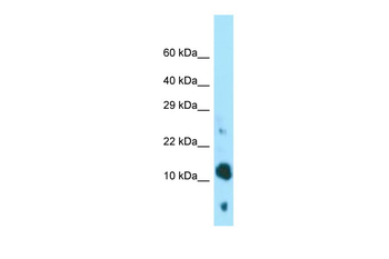 BEX4 Rabbit Polyclonal Antibody