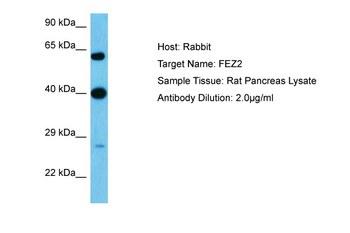 FEZ2 Rabbit Polyclonal Antibody