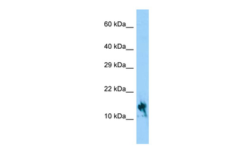 IGFL1 Rabbit Polyclonal Antibody