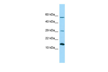 NDUFB4 Rabbit Polyclonal Antibody