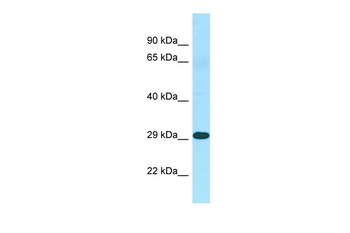 NSA2 Rabbit Polyclonal Antibody