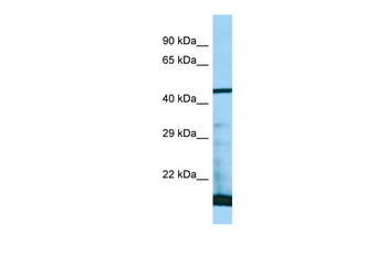 PAAF1 Rabbit Polyclonal Antibody