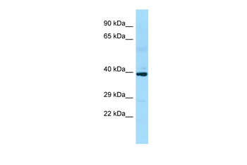 SLC35D2 Rabbit Polyclonal Antibody