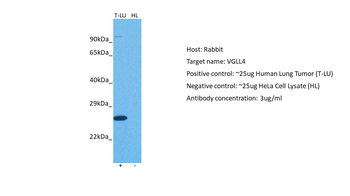 VGLL4 Rabbit Polyclonal Antibody