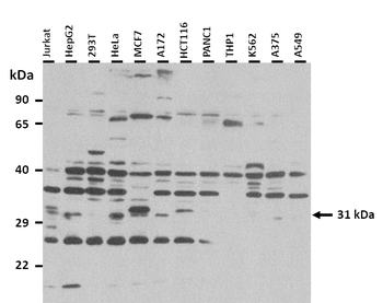 COLEC10 Rabbit Polyclonal Antibody