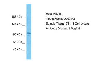 DLGAP3 Rabbit Polyclonal Antibody