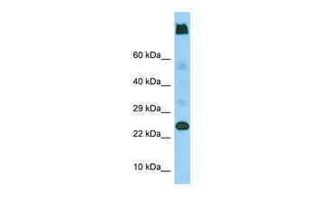 LY6G5C Rabbit Polyclonal Antibody
