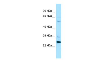 PARS2 Rabbit Polyclonal Antibody