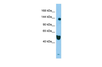RASAL2 Rabbit Polyclonal Antibody