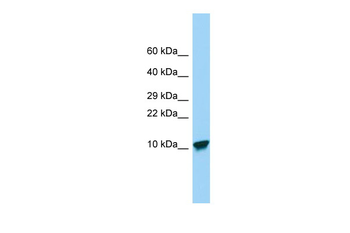 SPINK9 Rabbit Polyclonal Antibody