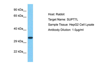 SUPT7L Rabbit Polyclonal Antibody
