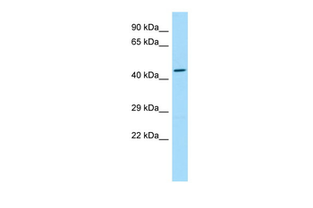 SLC35G2 Rabbit Polyclonal Antibody