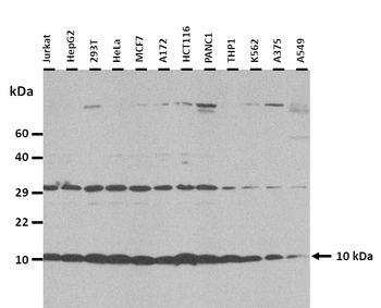 UQCRQ Rabbit Polyclonal Antibody