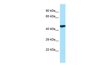 ANKRD33 Rabbit Polyclonal Antibody
