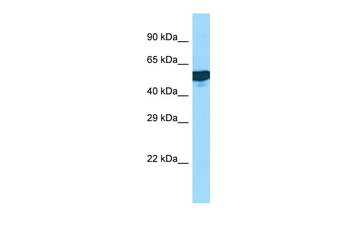 C1RL Rabbit Polyclonal Antibody