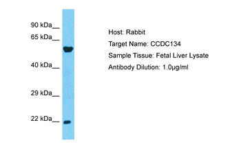 CCDC134 Rabbit Polyclonal Antibody