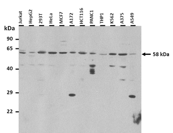 CCT6A Rabbit Polyclonal Antibody