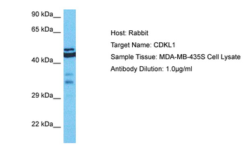 CDKL1 Rabbit Polyclonal Antibody