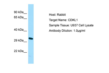 CDKL1 Rabbit Polyclonal Antibody