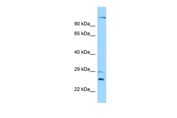 DNAH12 Rabbit Polyclonal Antibody