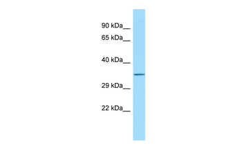 FAM49B Rabbit Polyclonal Antibody