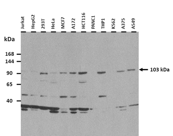HKDC1 Rabbit Polyclonal Antibody