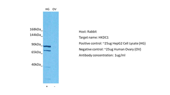 HKDC1 Rabbit Polyclonal Antibody