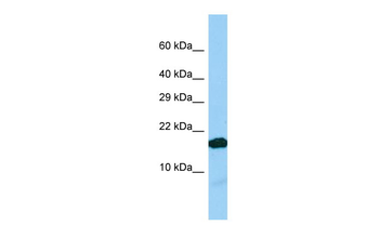 IGFL2 Rabbit Polyclonal Antibody