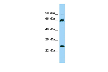 FARSB Rabbit Polyclonal Antibody