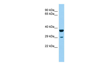 KCTD1 Rabbit Polyclonal Antibody