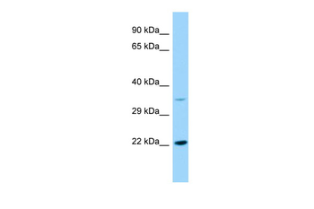 KDELR2 Rabbit Polyclonal Antibody