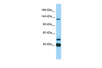 CAMSAP3 Rabbit Polyclonal Antibody