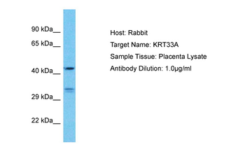 KRT33A Rabbit Polyclonal Antibody