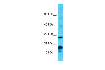 MS4A6E Rabbit Polyclonal Antibody